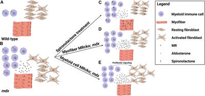 Mineralocorticoid Receptor Signaling in the Inflammatory Skeletal Muscle Microenvironments of Muscular Dystrophy and Acute Injury